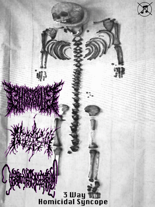Ghostslug : 3 Way Homicidal Syncope